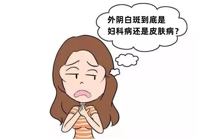 得了外阴白斑应该挂什么科？