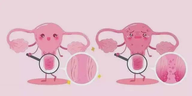 女性朋友患上外阴白斑后该怎么办？