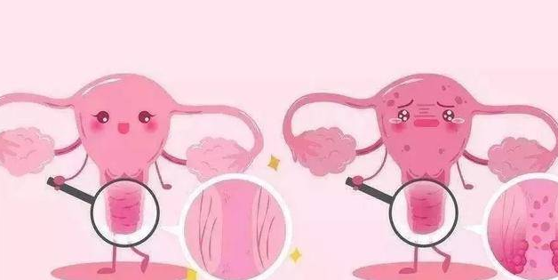 外阴不健康 外阴不健康