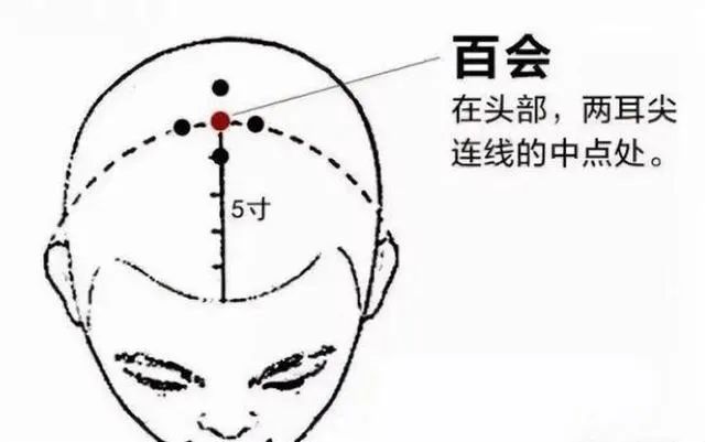 外阴白斑患者在冬天应该怎么养生