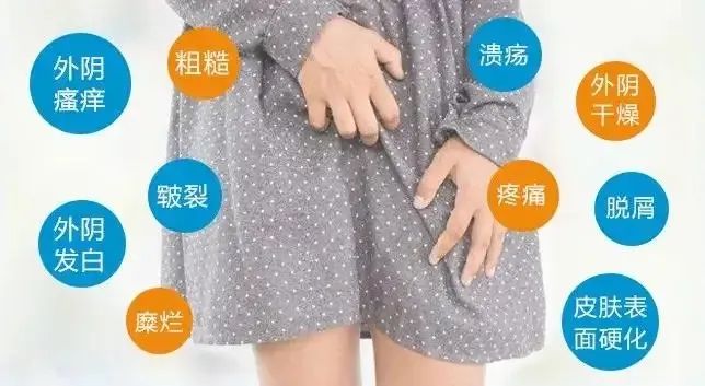 为什么外阴白斑病情会受天气影响？